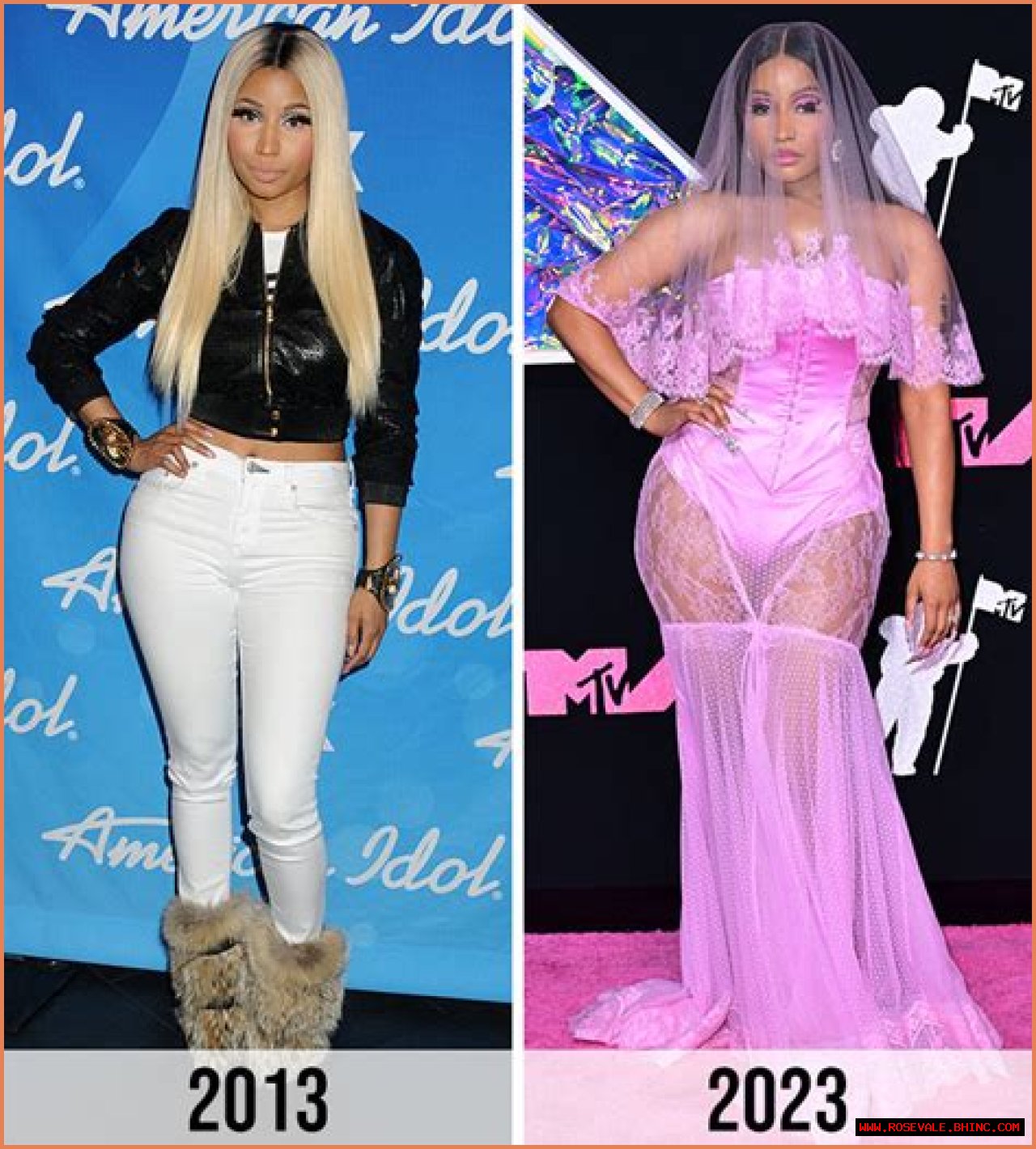 Did Nicki Minaj Ever Get Plastic Surgery? See Photos of Her Transformation Before and After! 