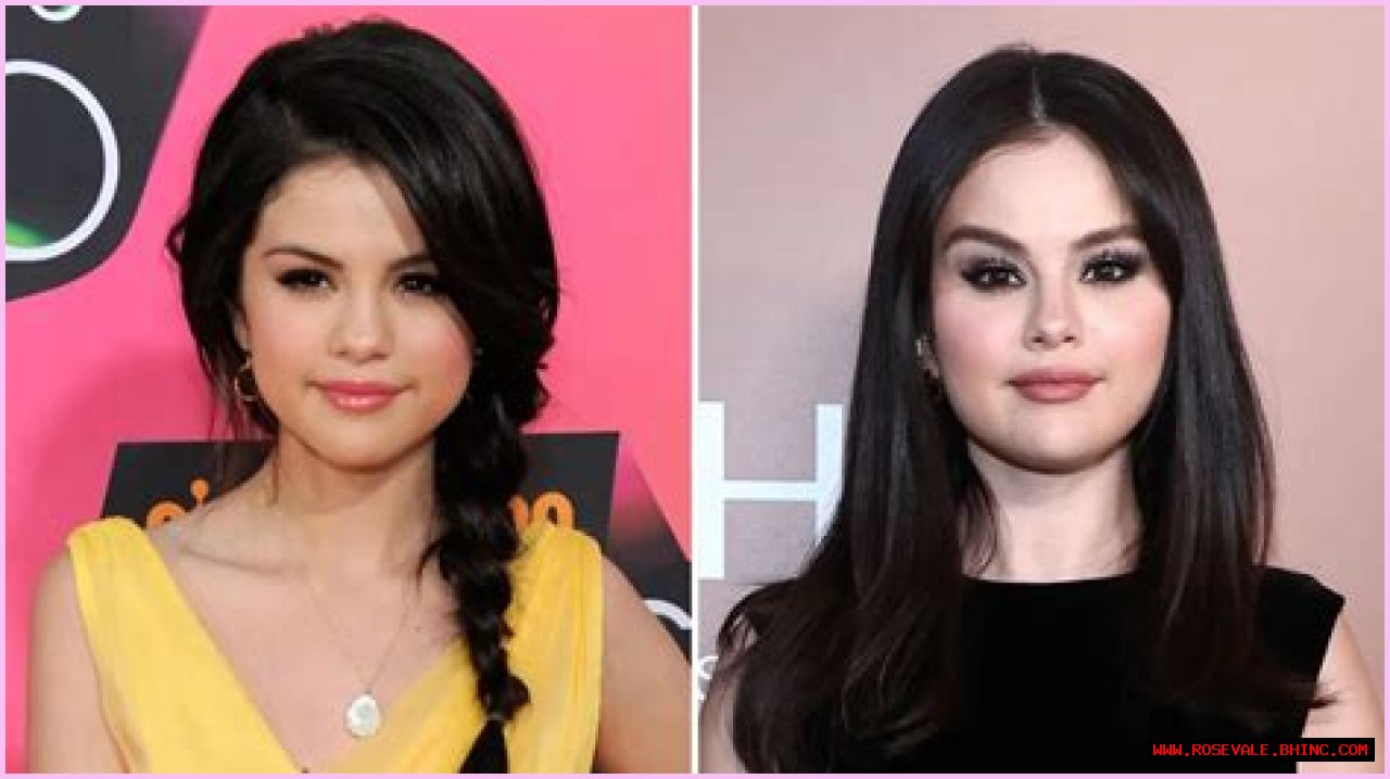 Did Selena Gomez Ever Get Plastic Surgery? Why She Has Sparked Rumors More Than Once