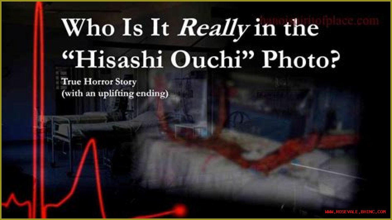 Hisashi Ouchi: The Tragic Story Behind The Real Picture