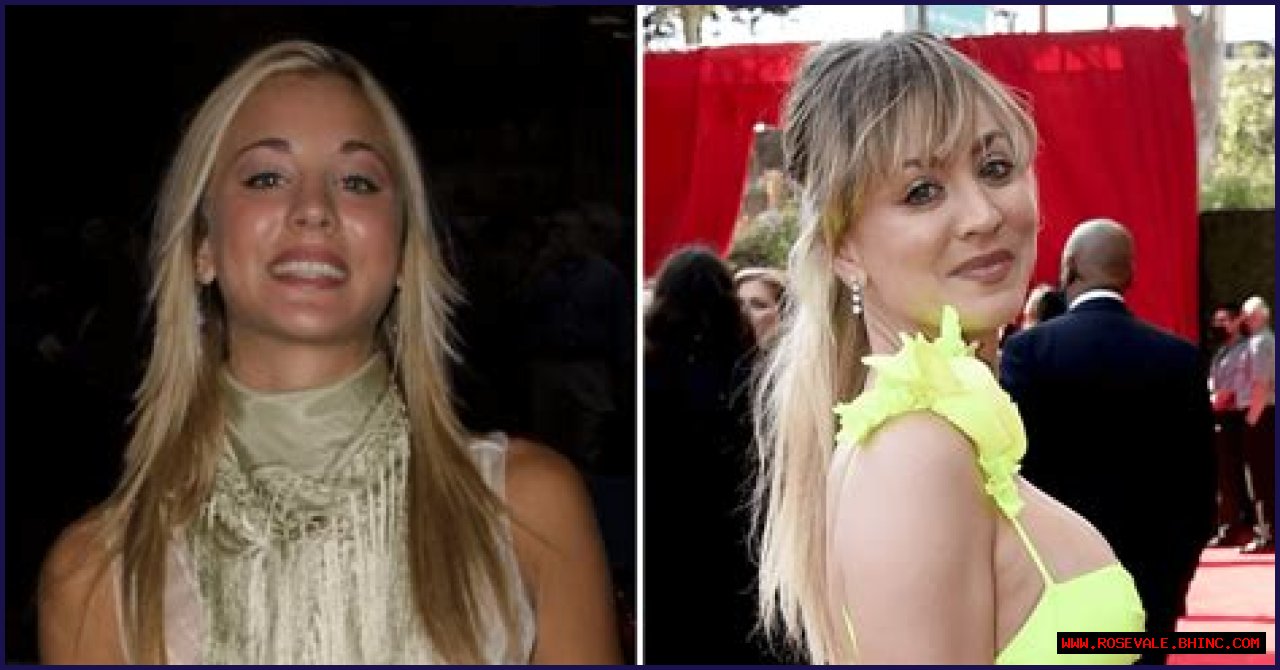 Kaley Cuoco Is Honest About Her Plastic Surgery! See the Actress’ Beautiful Transformation 