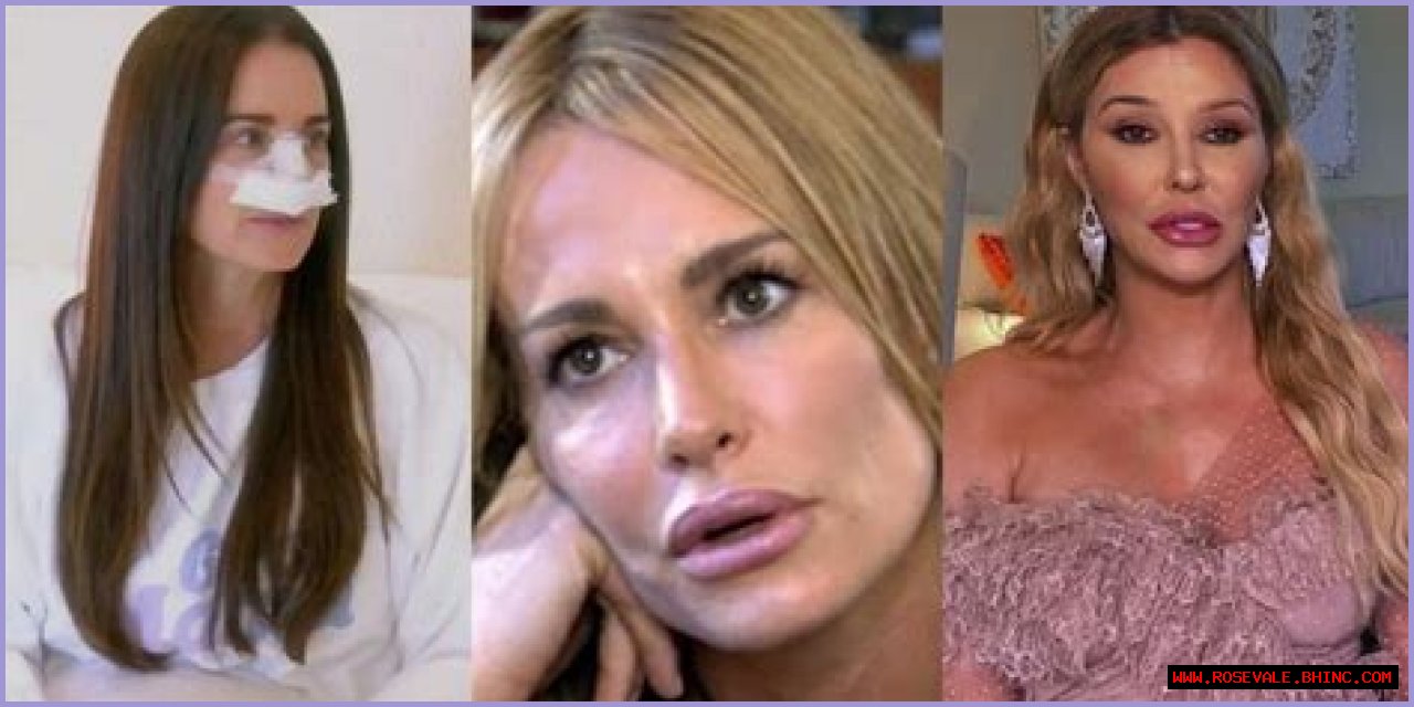 Kyle Richards’ Plastic Surgery: What Procedures the ‘RHOBH’ Star Has Admitted to Undergoing