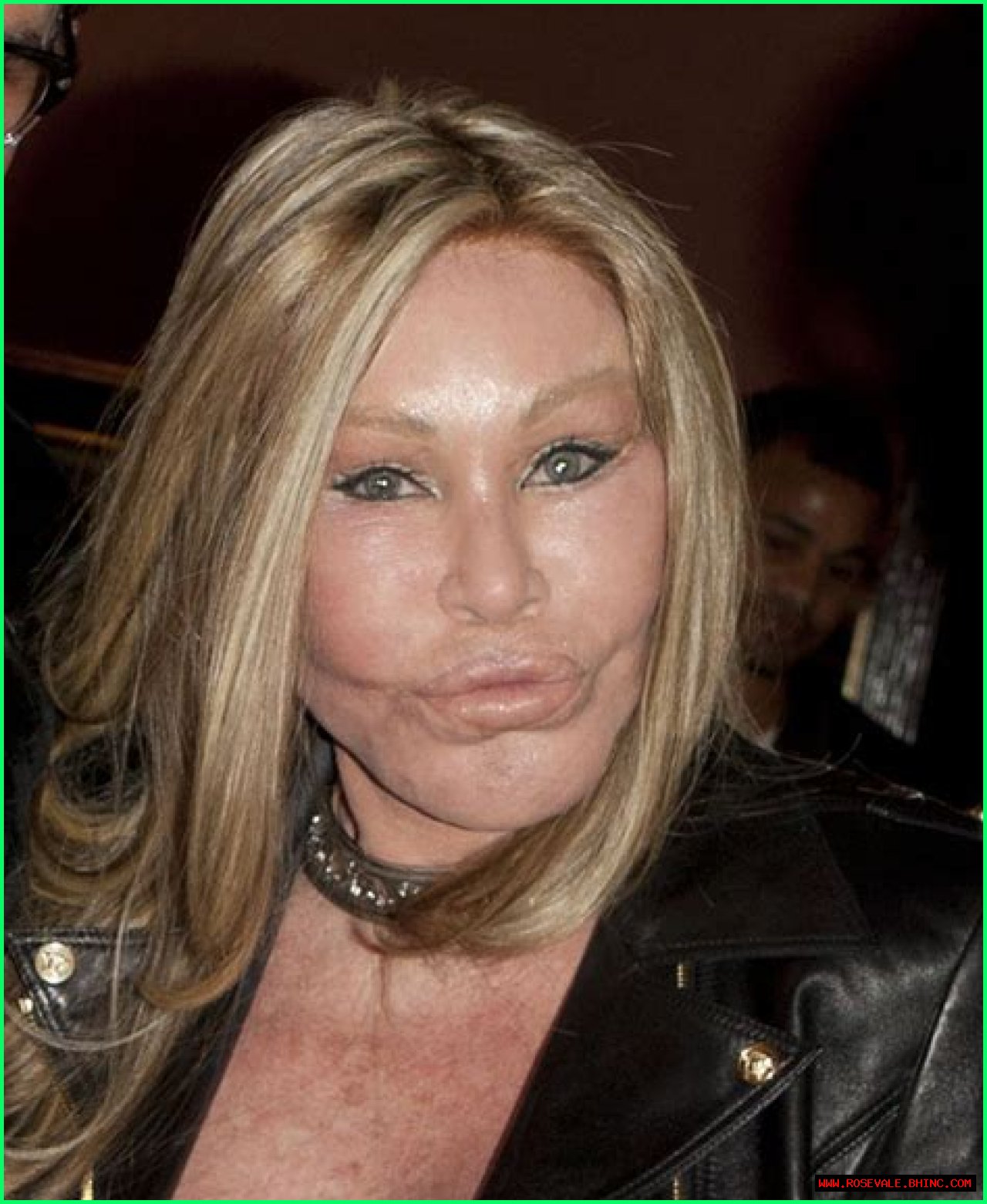 See Big Ang’s Shocking Plastic Surgery Transformation Right Before Your Eyes