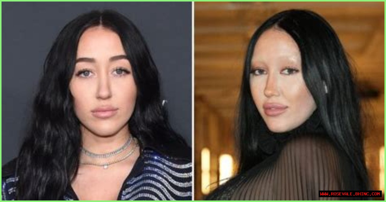 Unveiling The Truth: Did Noah Cyrus Get A Nose Job?
